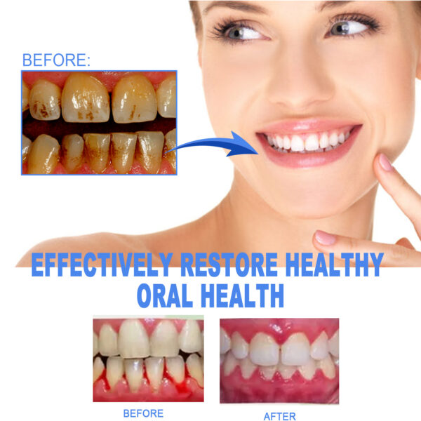EELHOE Dental Repair Gel, Repair Gums Cleaning Dental Stains And Tartar Oral Care Gel - Image 4